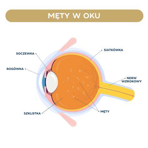 wizualizacja mętów oka i ich ruch